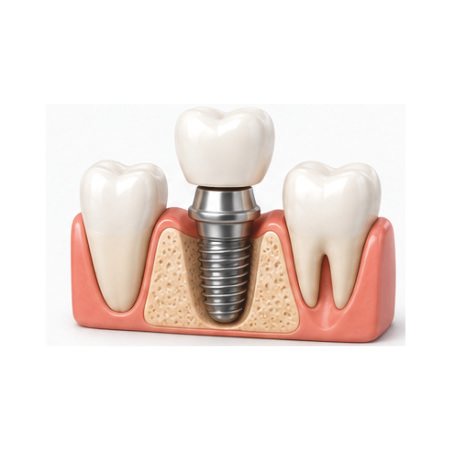 PowerClip Ellipse (3)